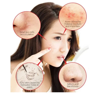 SOME BY MI. 30 Days Miracle Cleansing Bar. 1 pc.